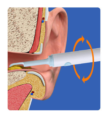 Rodinha de limpeza de ouvido visual inteligente Câmera médica Endoscópio para outros produtos químicos domésticos